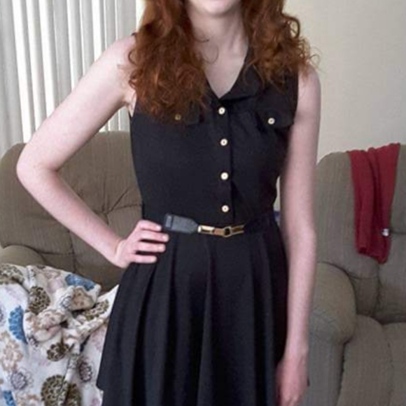 black button mini dress